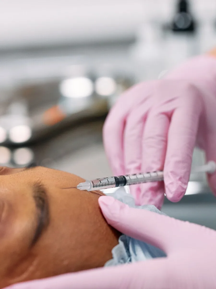 A nurse injector administering a neuromodulator injection to a client’s forehead