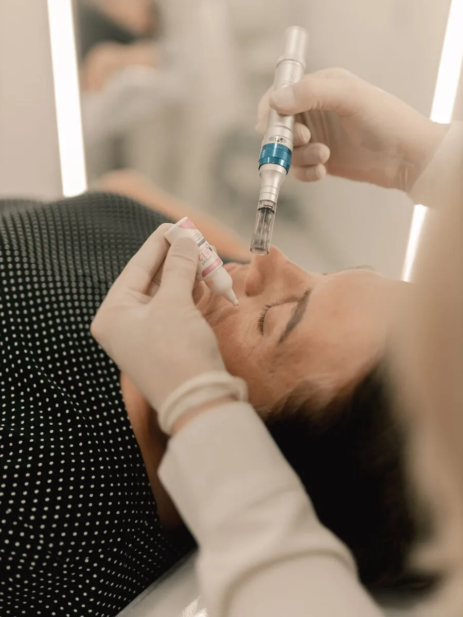 A microneedling pen being used during a facial treatment